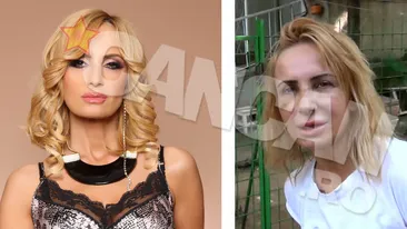 Recuperarea este greoaie, iar semnele vizibile! Gyorfi a renuntat la bandaje si la pudoare si-si scoate fata tumefiata in lume