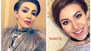 Nicoleta Nucă nu şi-a operat doar nasul în Turcia, ci şi… A ascuns că şi-a pus silicoane!
