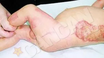 Chiar daca a vazut moartea cu ochii, din cauza unui cadru medical, micutul uitat in incubator vrea sa se faca medic!