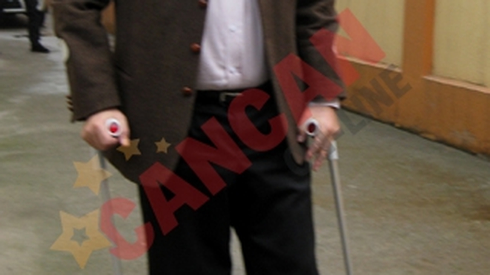 Deputatul Mircea Toader, in carje