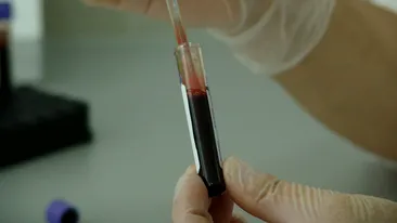 Poți dona plasmă după ce te-ai vaccinat împotriva Covid-19? Ministerul Sănătății face anunțul 