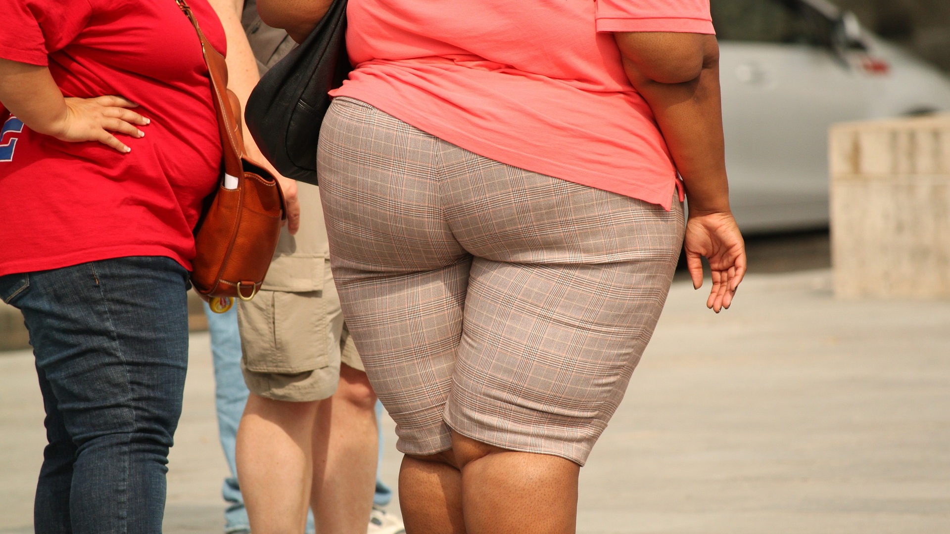 Premieră în Iași! Incredibil ce au descoperit medicii în burta unei femei care cântărește 220 de kg. Femeia avea dureri abdominale