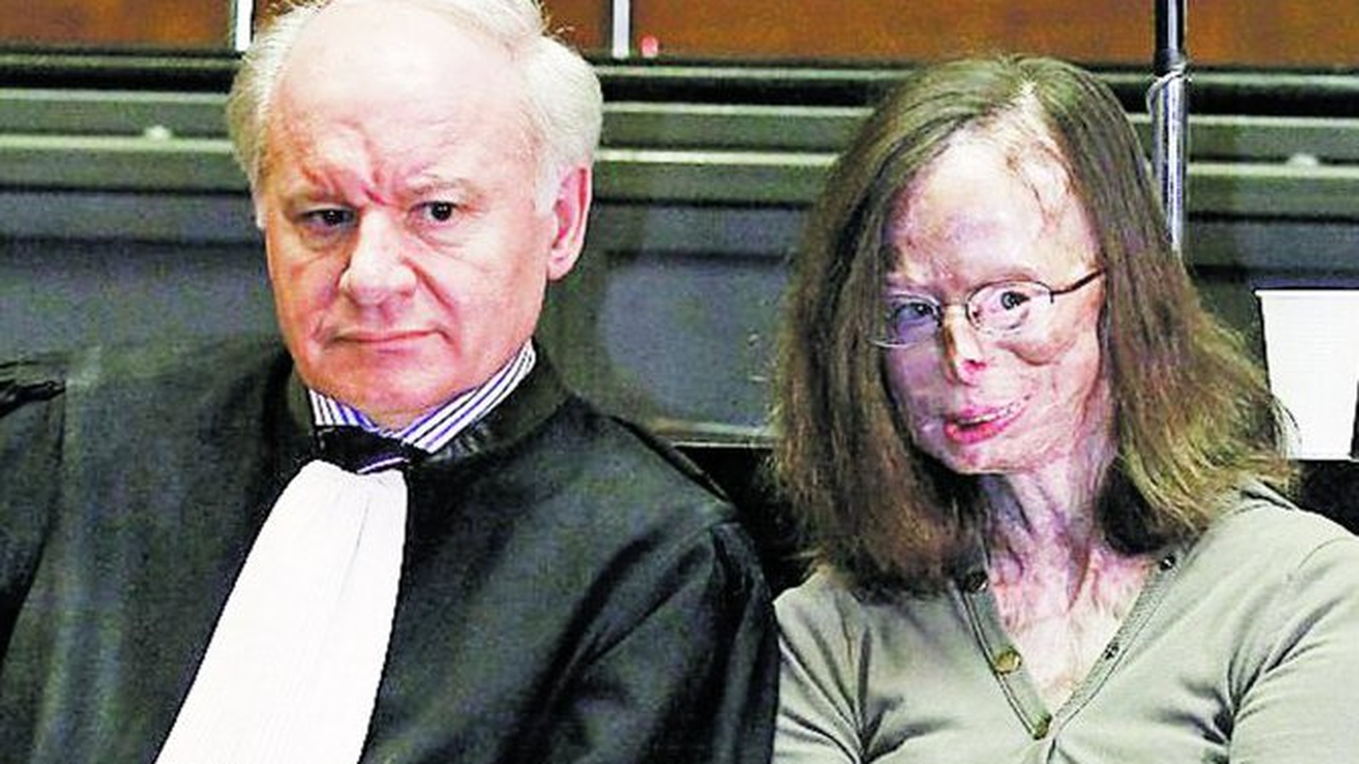 Cazul socant al unei femei din Belgia! Asa arata dupa 86 de operatii estetice