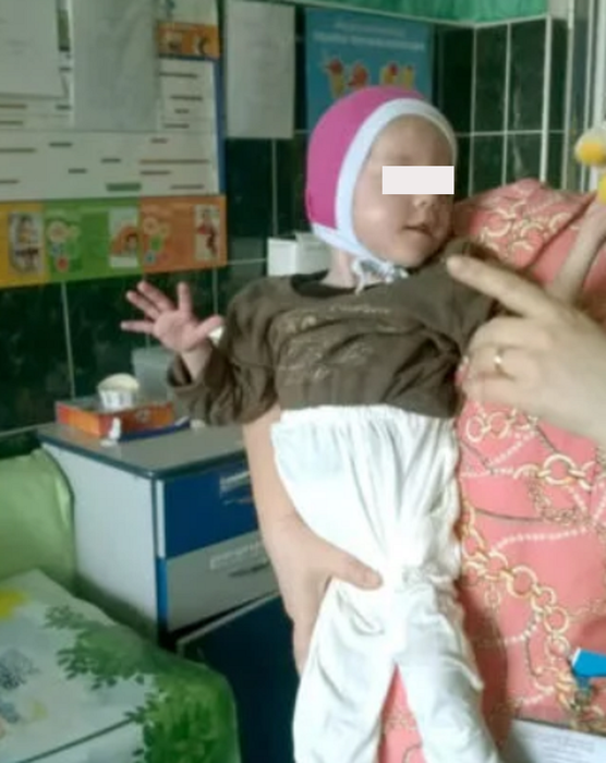Cum arată acum fetița care a crescut cu pufuleți până la 4 ani: ”Când s-a văzut a început să plângă”