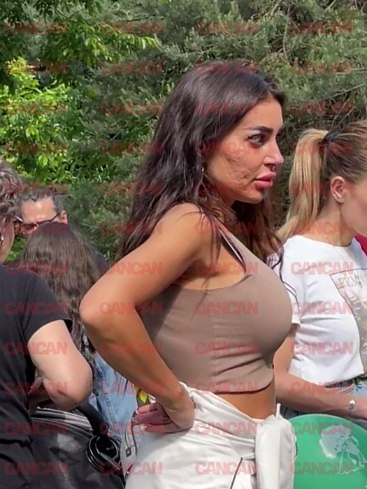 Se luptă cu acneea agresivă de ani buni / (Sursa: CANCAN.RO)