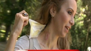 Dupa ce a fost arsa pe gat cu ondulatorul, Annes se gandeste sa-si faca un tatuaj pentru a acoperi cicatricea