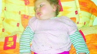 Necesita transplant la numai doi ani