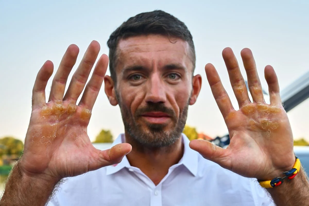 Imagini greu de digerat. Cum arată palmele canotorilor de la JO 2024. Ai curaj să le vezi?