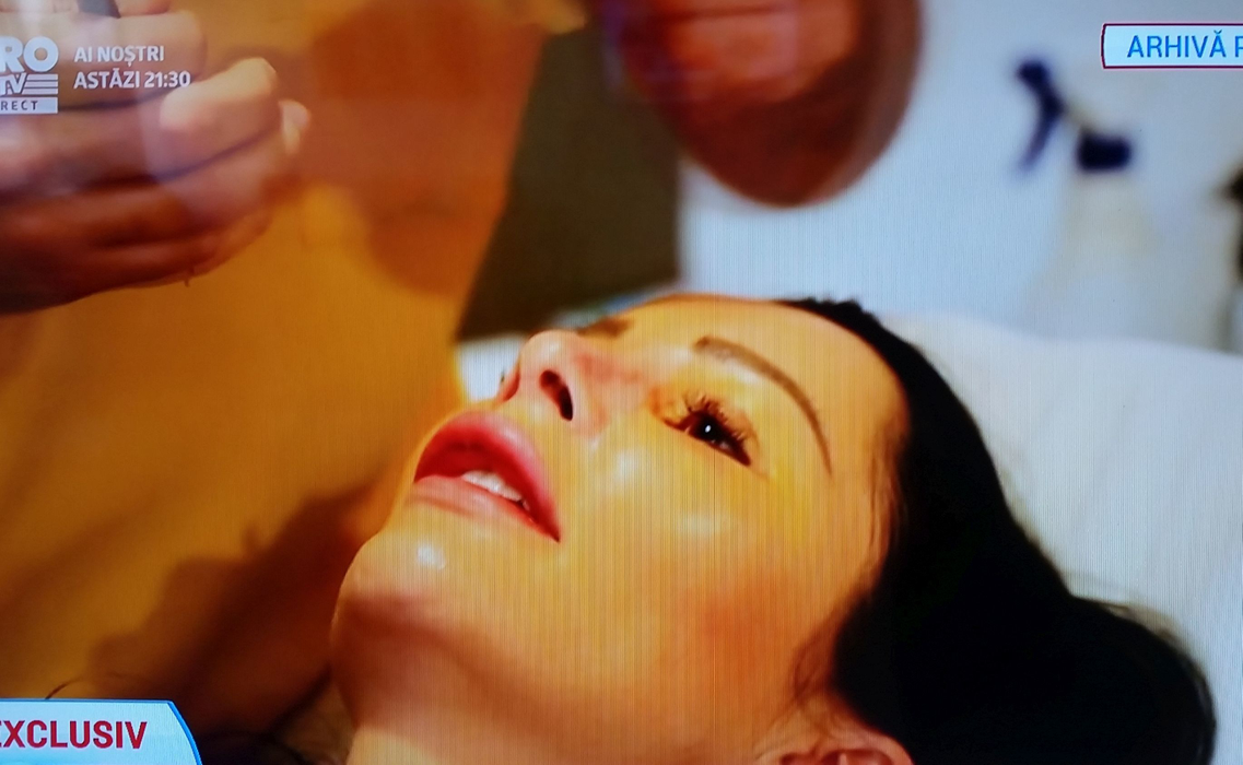 Brigitte le-a arătat tuturor imaginile din sala de operaţie.