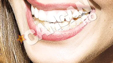 Vandici a intrat in reparatii capitale. Poarta aparat dentar si umbla cu sprancenele desenate