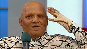 Bolnav de cancer, Marian Darta e DISPERAT! Ce spune despre sedintele de chimioterapie pe care trebuie sa le faca!