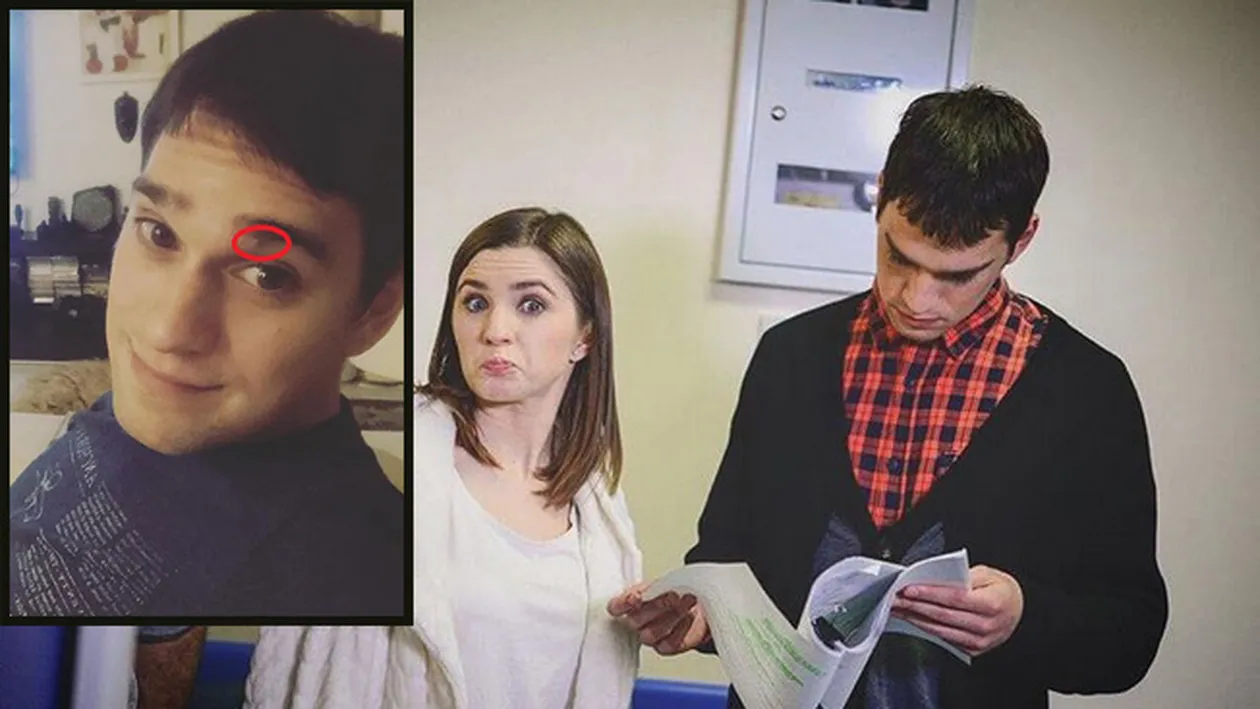 Vlad Gherman, cu fața vânătă după ce a ajuns la bisturiu: Și-a scos alunița de la.... Primele imagini după operația la care a fost supus tânărul actor