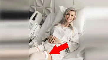 Adevărul cutremurător din spatele acestei poze cu Andreea Bălan. De ce poartă jartiere pe patul de spital