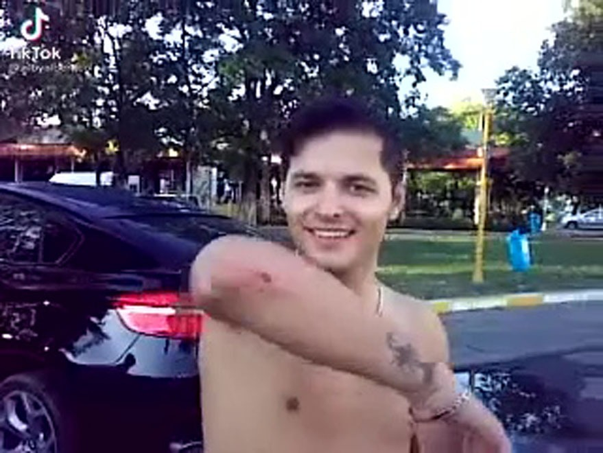 Liviu Vârciu și rana lui din cot/ Sursă foto: captură video