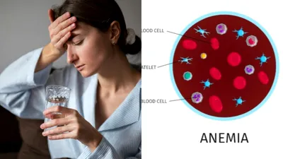 Cauzele ascunse ale carenței de fier. Mulți români ignoră simptomele!