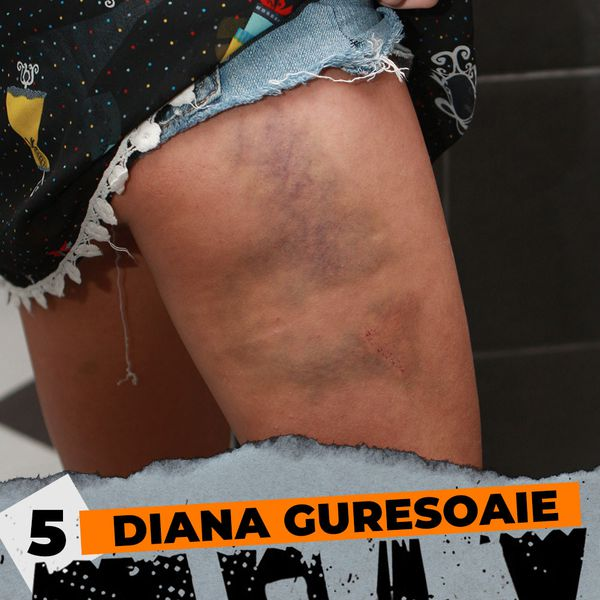 Bianca Drăgușanu nu e singura! TOP 20 – Vedete din România rupte cu bătaia de iubiții lor