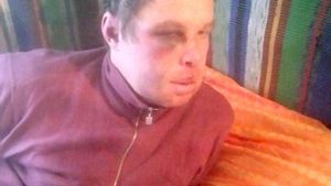 IMAGINI ŞOCANTE. Scene de Local Kombat la Spitalul de Psihiatrie din Iaşi. Un bolnav a fost stâlcit în bătăie