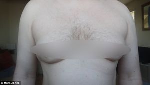 A vrut sa scape de "sanii de femeie" si sa arate ca un barbat normal! Rezultatul este insa INGROZITOR!