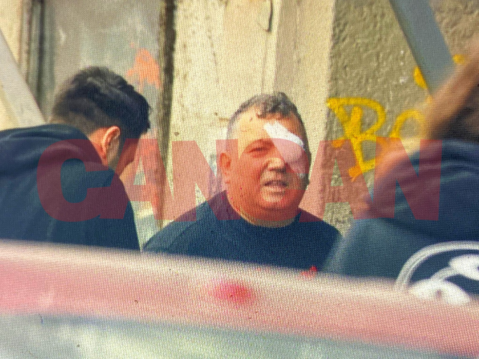 Nuredin Beinur, după ce a primit îngrijiri medicale (Foto: CANCAN.RO)