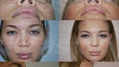 Adina Alberts: Gina Pistol nu e obsedata de interventiile estetice Uite cum arata iepurasul Playboy inainte si dupa operatii!