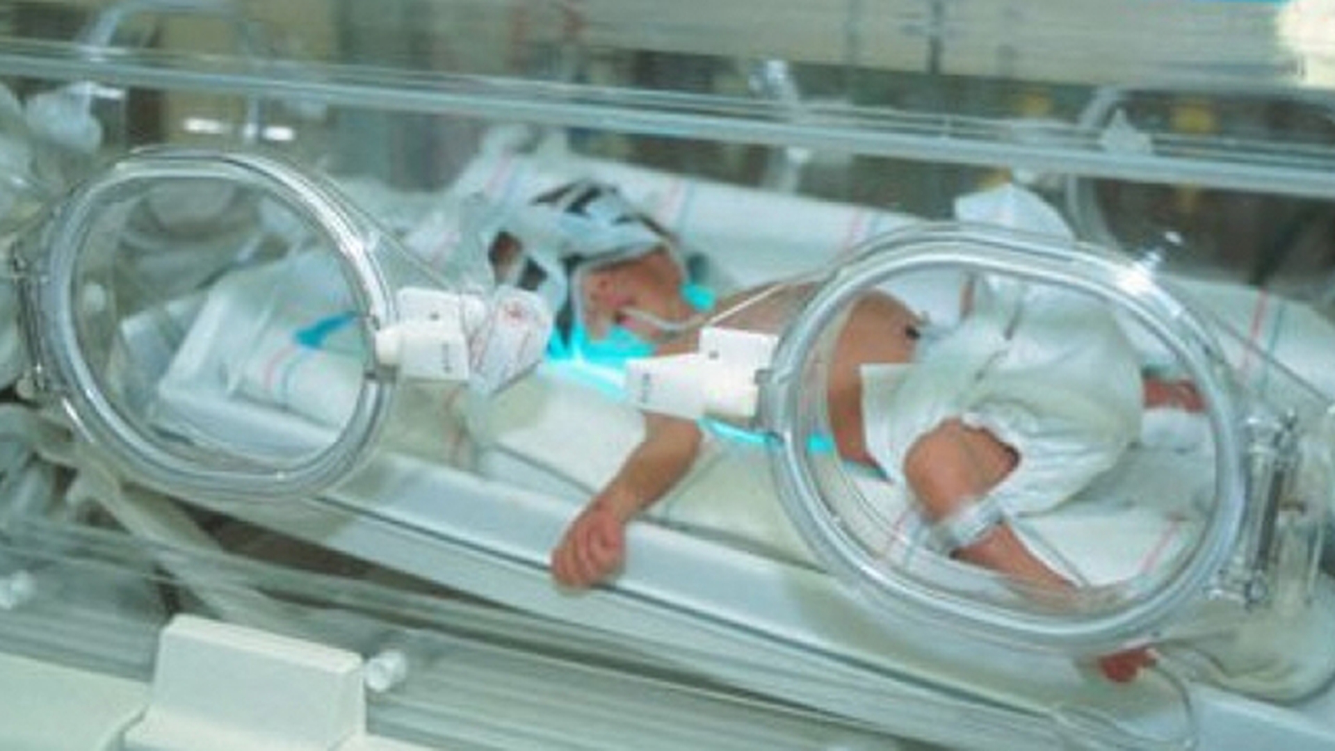 Imagini greu de privit! Medicilor nu le-a venit sa creada cand au vazut cum arata acest bebelus