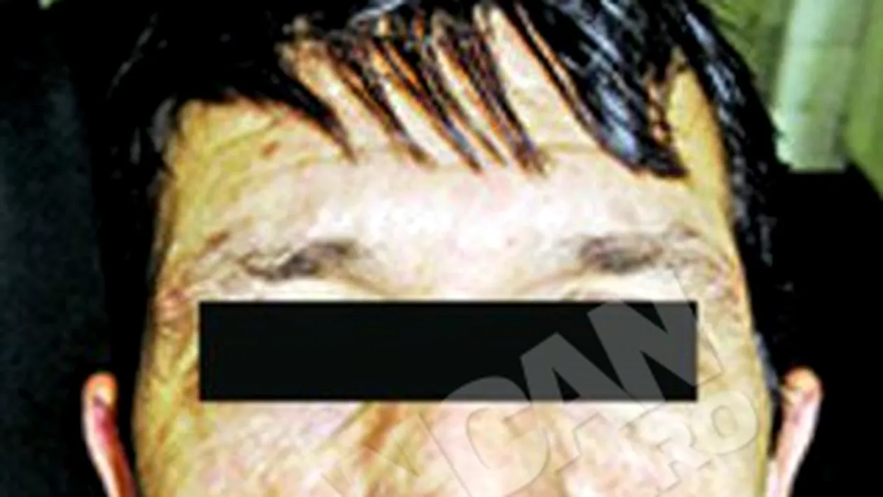 I-au pus un muschi pe post de limba!