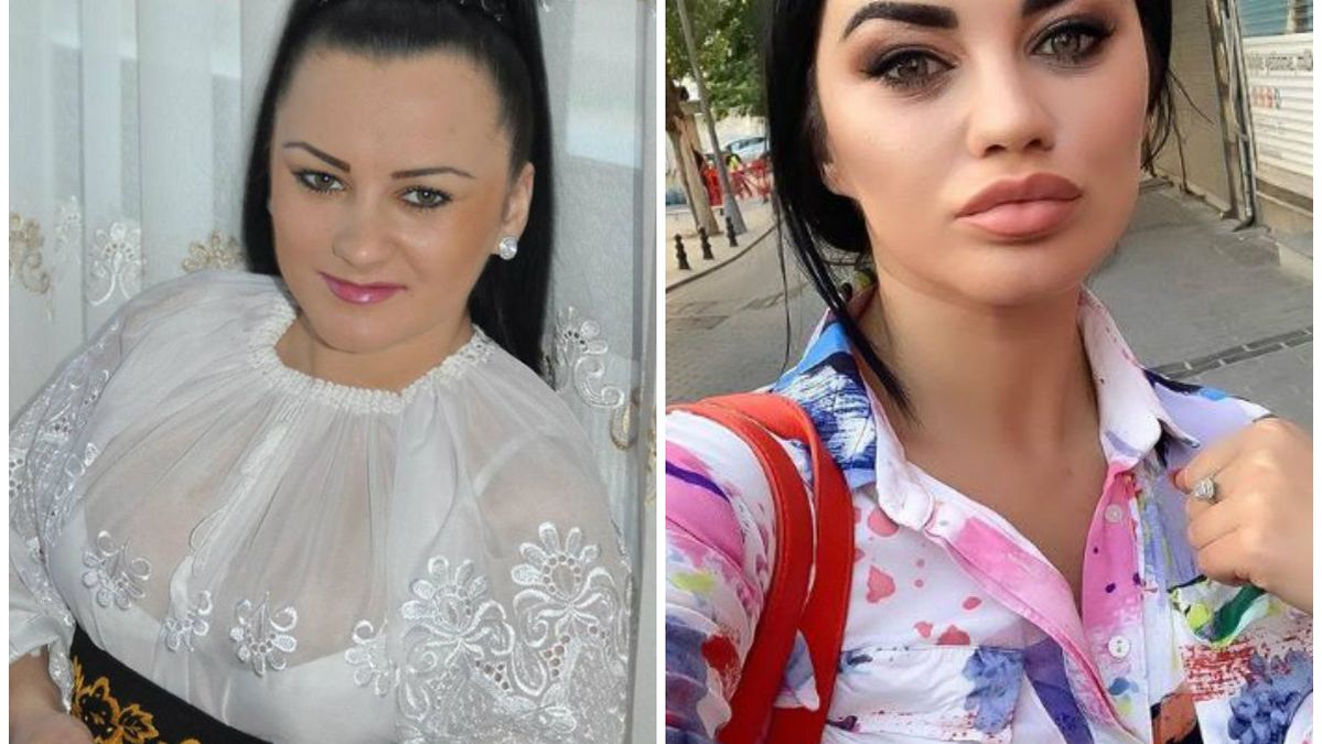 Adevăratul motiv pentru care Carmen de la Sălciua a trecut pragul medicului estetician: ”O să vă răspund”