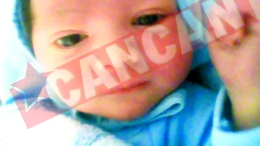 Bebelusul ars lupta pentru viata sa