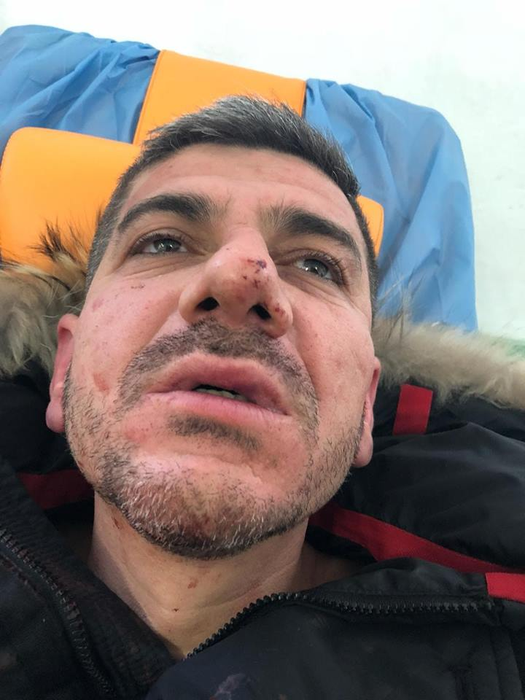 Găbiță de la Buzău, bătut de patronul unei discoteci