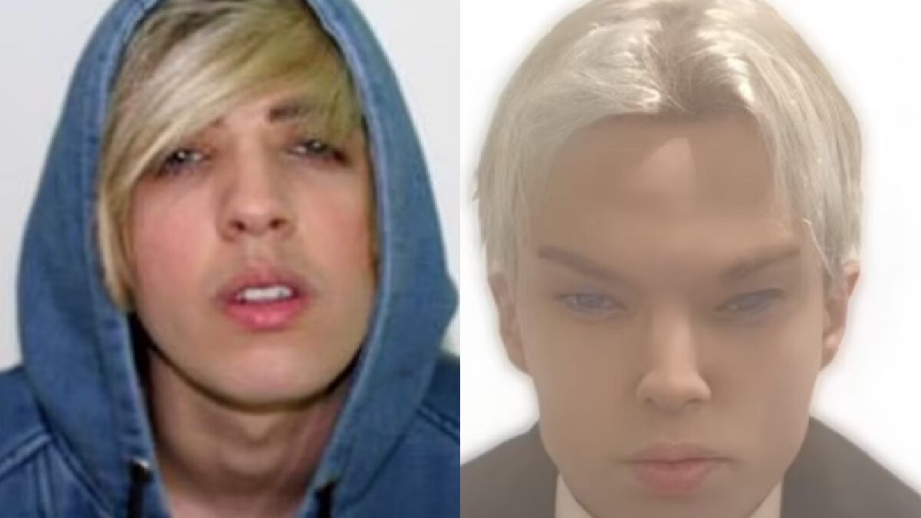 Un actor celebru a murit din cauza unei operații estetice. A cheltuit 220.000 de dolari ca să arate precum idolul său