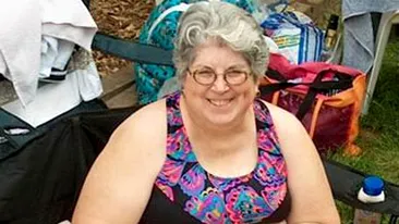 Ca sa scape de obezitate, 300.000 de romani ar trebui sa-si faca operatii estetice