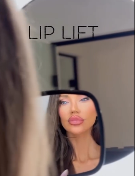 Cum arată Bianca Drăgușanu după intervenția de lip lift. A trecut aproape o lună de când și-a modificat buzele