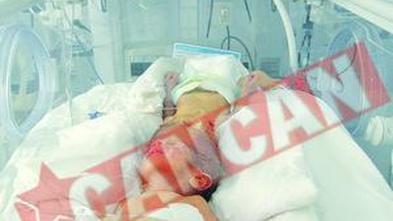 Viata siamezilor de la Brasov atarna de un fir de par