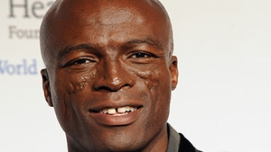 Seal vine in Romania cu pretentii de vedeta! Uite ce isi doreste sa manance inainte de concert!