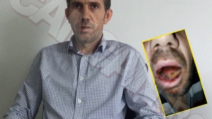 Ginerele şi fratele ”Regelui de la Tărtăşeşti” sunt acuzaţi că au tocat în bătaie un bărbat ”Păpuşelul şi milionarul smardoi m-au desfigurat la manele!”