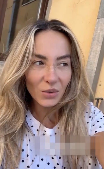 Cum arată Flavia Mihășan la 3 săptămâni de la operația la nas. Vedeta e schimbată total!