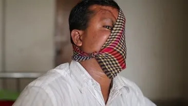 A ramas mutilat, dupa ce a fost atacat de un tigru! Dupa 23 de ani, barbatul a decis sa isi arate chipul desfigurat. E infiorator