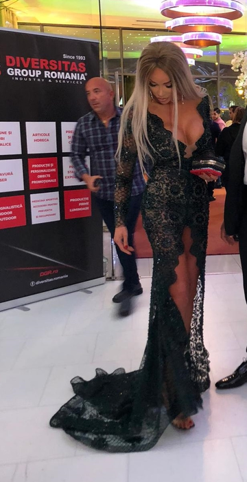 Bianca Drăgușanu, cu o vânătaie imensă pe bust. A fost lovită în sâni?!