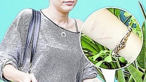 Taieturile suspecte de pe bratele vedetei dezvaluie un adevar socant! Miley Cyrus se raneste din nou