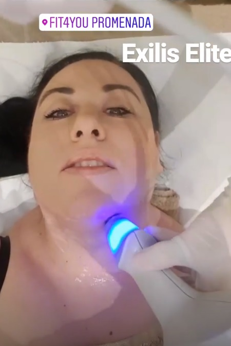 Oana Roman “și-a sculptat” fața! S-a filmat în timpul procedurii estetice
