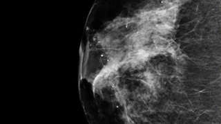 Se reprofilzeaza NASA?! Mai nou face si mamografii, folosind tehnologia pentru studierea cosmosului