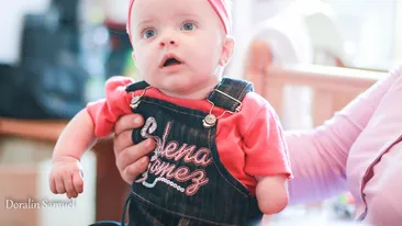 Vreau si eu doua manute! Sara are un an si are nevoie de o proteza ca sa poata duce o viata normala!