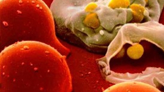 Un german a fost arestat pentru ca si-a contaminat cu HIV fosta iubita