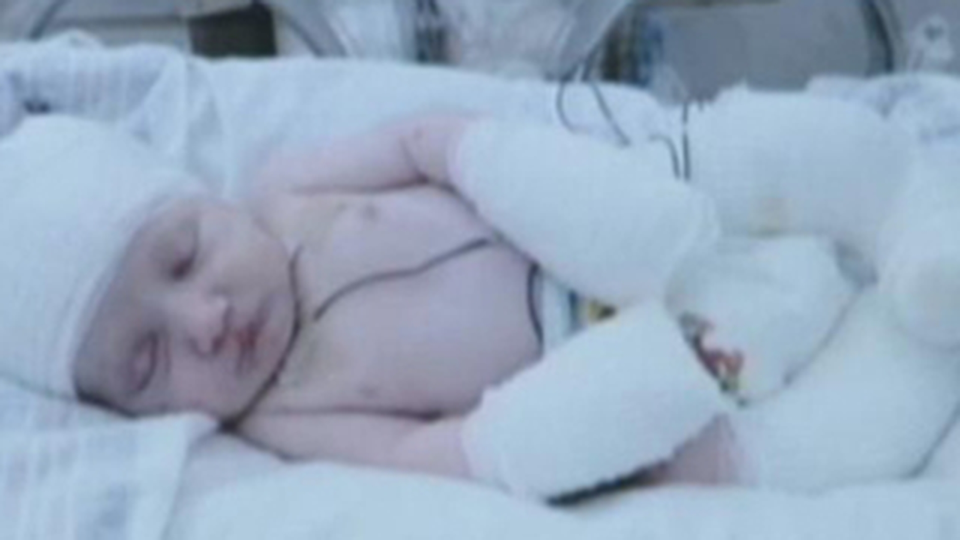 VIDEO Un bebelus s-a nascut fara piele! Medicii aproape ca ii puteau vedea creierul