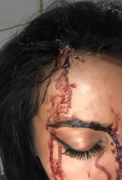 Prezentatoarea TV a ajuns plină de sânge la spital. Imagini cu puternic impact emoțional