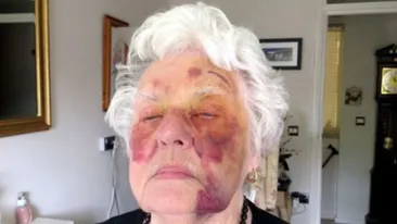 Motivul INCREDIBIL ce a adus-o pe această bătrână aproape de moarte! Mergea pe stradă, când i s-a intâmplat ASTA
