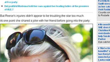 Uite cum arata Reese Witherspoon dupa ce a fost lovita de masina!