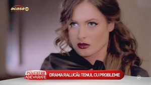 Raluka vorbeşte deschis despre problemele grave ale tenului său: "De 10 ani nu am reuşit să le dau de cap"