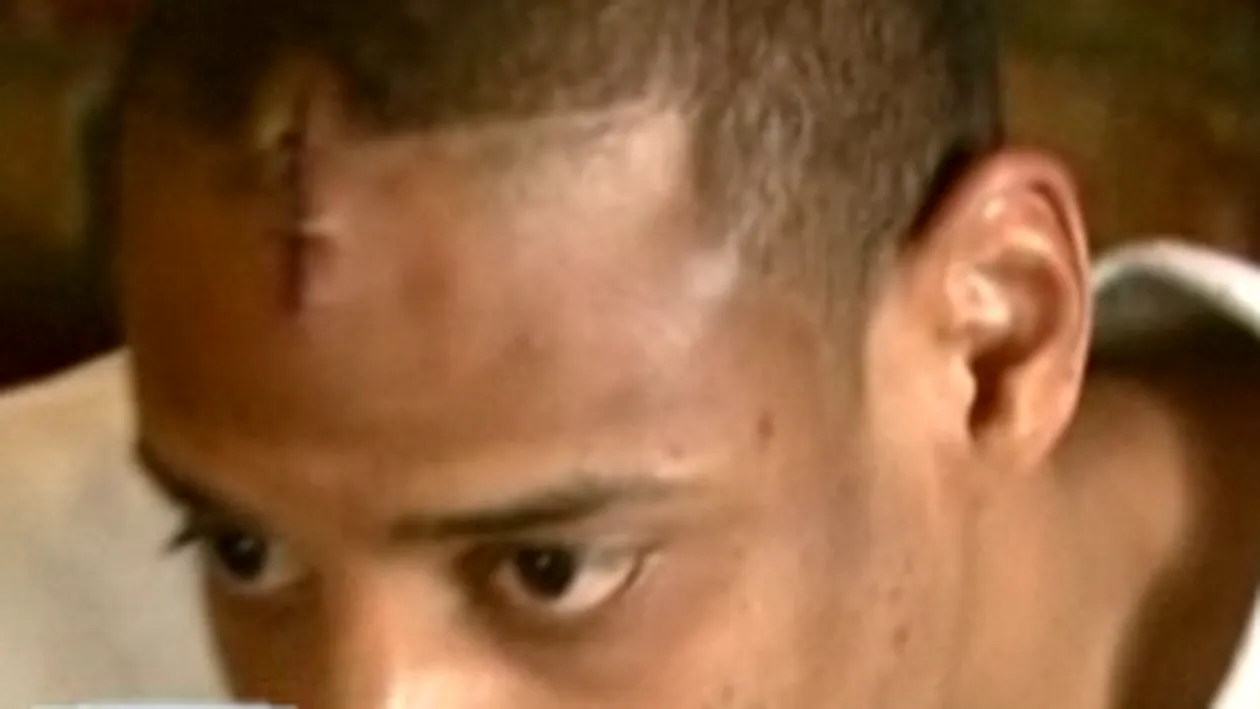 Vedeta NBA batuta intr-un club din Capitala: Bodyguarzii au scos bastoanele, erau cel putin sase si m-au batut ca pe un caine