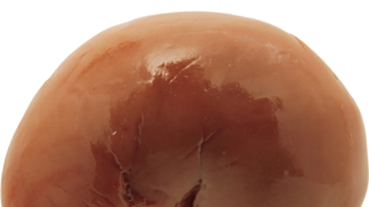 Vrei un rinichi? Ai nevoie de ficat? In Romania, organele se vand cu preturi cuprinse intre 25.000 si 40.000 de euro!